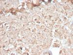 CELA3B/ELA3B (Pancreatic Function Marker) Recombinant Rabbit Monoclonal Antibody (CELA3B/2810R)