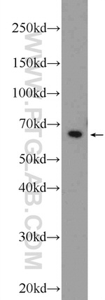 PHACTR1 Antibody in Western Blot (WB)