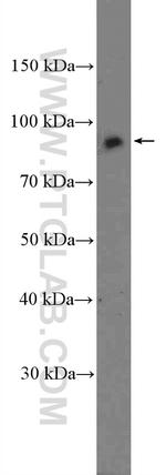 TNFAIP3 Antibody in Western Blot (WB)