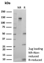 FOLH1/PSMA (Prostate Epithelial Marker) Antibody in SDS-PAGE (SDS-PAGE)