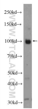 ESF1 Antibody in Western Blot (WB)