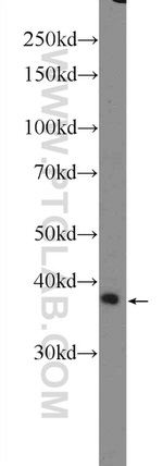 HOXD13 Antibody in Western Blot (WB)