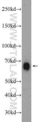 ESCO2 Antibody in Western Blot (WB)