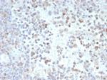 PRAME nuclear receptor transcriptional regulator Monoclonal Antibody (PRAME/9189)