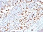 PRAME nuclear receptor transcriptional regulator Recombinant Rabbit Monoclonal Antibody (PRAME/6928R)
