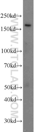 PCF11 Antibody in Western Blot (WB)