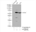 LBP Antibody in Immunoprecipitation (IP)