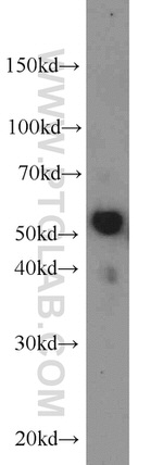 LBP Antibody in Western Blot (WB)