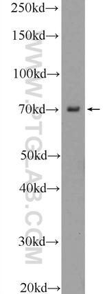 VSX1 Antibody in Western Blot (WB)