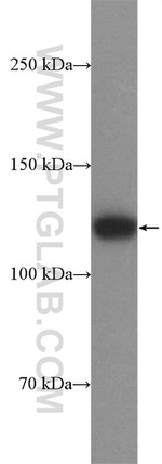 SMTN Antibody in Western Blot (WB)