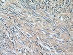 SMTN Antibody in Immunohistochemistry (Paraffin) (IHC (P))