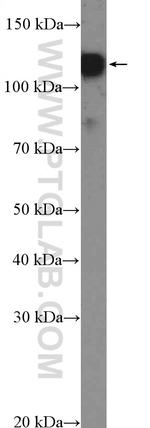 SMTN Antibody in Western Blot (WB)