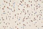 PEG3 Antibody in Immunohistochemistry (Paraffin) (IHC (P))