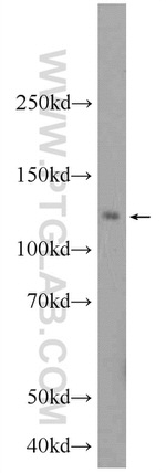 NFKB1 p105 Antibody in Western Blot (WB)