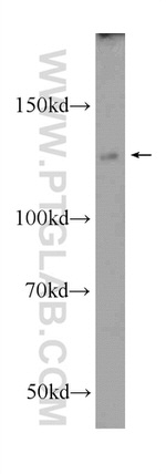 NFKB1 p105 Antibody in Western Blot (WB)