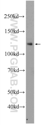 NFKB1 p105 Antibody in Western Blot (WB)