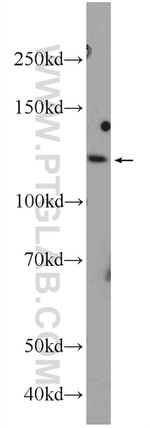 NFKB1 p105 Antibody in Western Blot (WB)