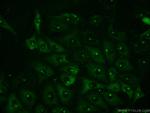 NFKB1 p105 Antibody in Immunocytochemistry (ICC/IF)