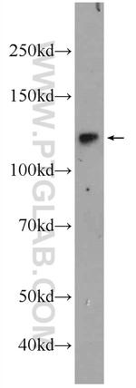 NFKB1 p105 Antibody in Western Blot (WB)