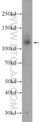 DAB2IP Antibody in Western Blot (WB)