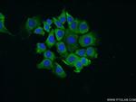RPS25 Antibody in Immunocytochemistry (ICC/IF)