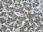 RPS25 Antibody in Immunohistochemistry (Paraffin) (IHC (P))