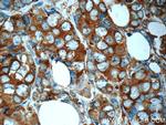 RPS25 Antibody in Immunohistochemistry (Paraffin) (IHC (P))
