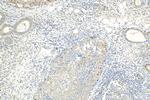 RPS25 Antibody in Immunohistochemistry (Paraffin) (IHC (P))