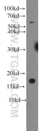 RPS25 Antibody in Western Blot (WB)