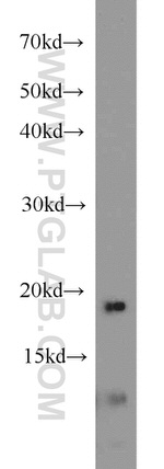 RPS25 Antibody in Western Blot (WB)