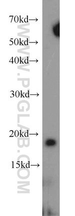 RPS25 Antibody in Western Blot (WB)