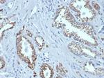 AMACR/p504S (Prostate Cancer Marker) Monoclonal Antibody (rAMACR/6369)