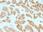 AMACR/p504S (Prostate Cancer Marker) Antibody in Immunohistochemistry (Paraffin) (IHC (P))