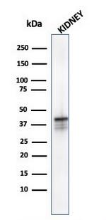 AMACR/p504S (Prostate Cancer Marker) Antibody in Western Blot (WB)