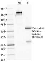 AMACR/p504S (Prostate Cancer Marker) Antibody in SDS-PAGE (SDS-PAGE)
