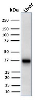 AMACR/p504S (Prostate Cancer Marker) Antibody in Western Blot (WB)