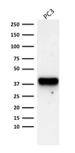 AMACR/p504S (Prostate Cancer Marker) Antibody in Western Blot (WB)
