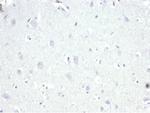 AMACR/p504S (Prostate Cancer Marker) Antibody in Immunohistochemistry (Paraffin) (IHC (P))