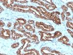 AMACR/p504S (Prostate Cancer Marker) Antibody in Immunohistochemistry (Paraffin) (IHC (P))