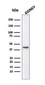 AMACR/p504S (Prostate Cancer Marker) Antibody in Western Blot (WB)