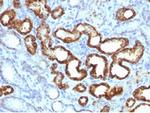 AMACR/p504S (Prostate Cancer Marker) Antibody in Immunohistochemistry (Paraffin) (IHC (P))