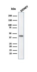 AMACR/p504S (Prostate Cancer Marker) Antibody in Western Blot (WB)