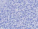 AMACR/p504S (Prostate Cancer Marker) Recombinant Rabbit Monoclonal Antibody (AMACR/8350R)
