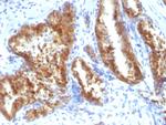 AMACR/p504S (Prostate Cancer Marker) Polyclonal Antibody