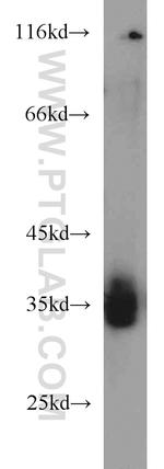 TIMMDC1 Antibody in Western Blot (WB)