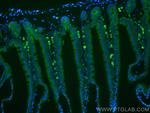 MRGPRD Antibody in Immunohistochemistry (PFA fixed) (IHC (PFA))