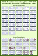 TRIM29 (Lung Squamous Cell Carcinoma Marker) Monoclonal Antibody (MSVA-629M)