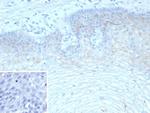 TRIM29 (Lung Squamous Cell Carcinoma Marker) Recombinant Rabbit Monoclonal Antibody (TRIM29/9257R)