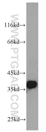 P15RS Antibody in Western Blot (WB)