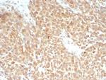 SLC7A11/xCT Recombinant Rabbit Monoclonal Antibody (SLC7A11/9136R)
